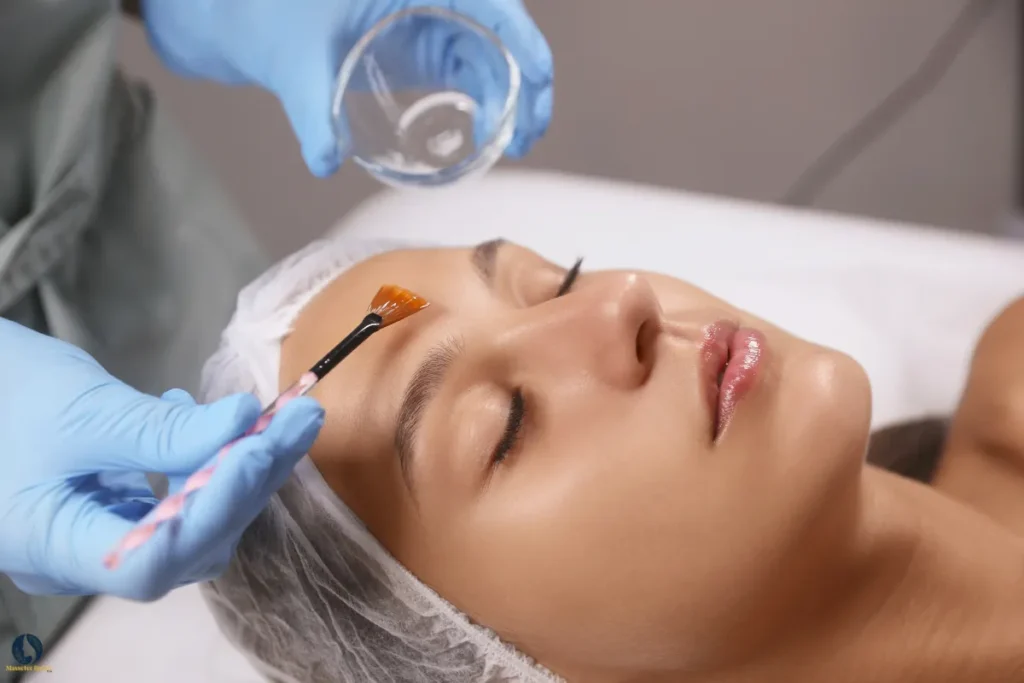 Chemical Peels & Skin Renewal Irvine